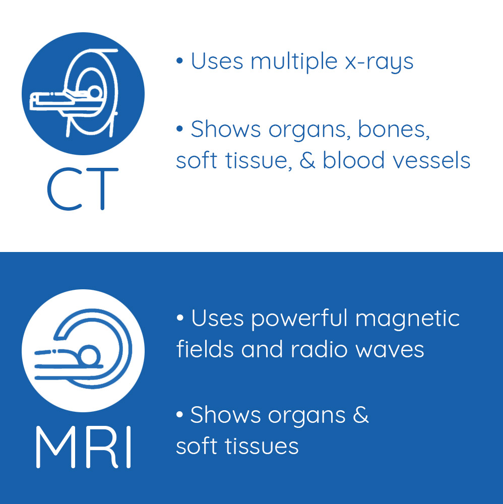 What is the difference between MRI and CT Scans?