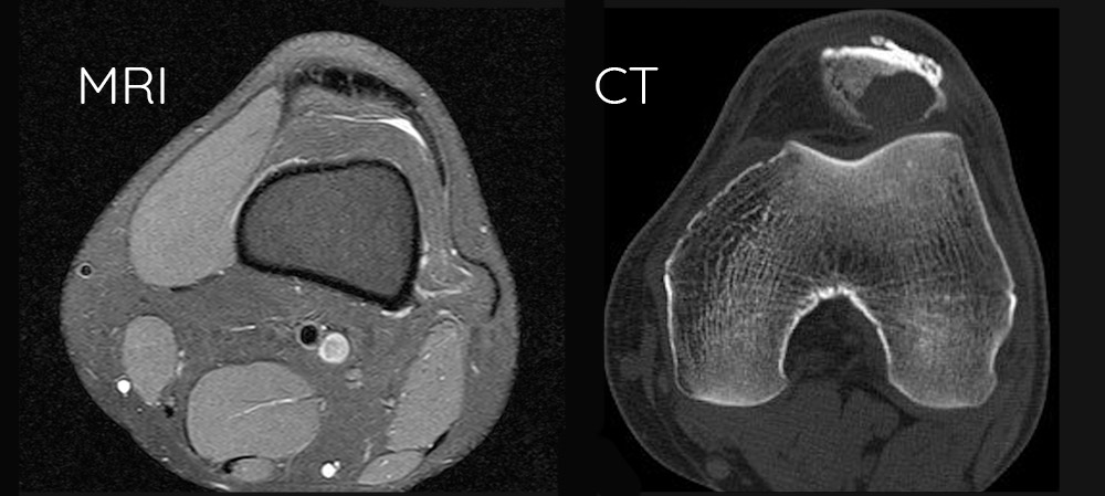 What the difference MRI and CT | PDI